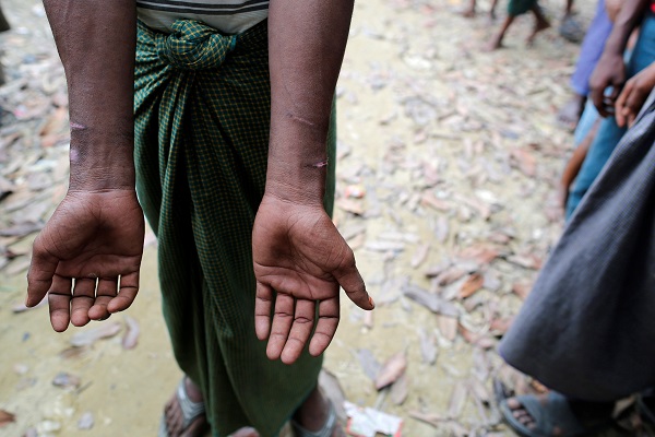A man, who said he was arrested by Myanmar army and then released, shows scars on his hands at a Rohingya village outside Maugndaw in Rakhine state, Myanmar October 27, 2016. REUTERS/Soe Zeya Tun